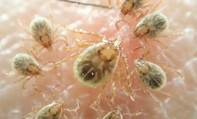 寄生虫を介した感染症